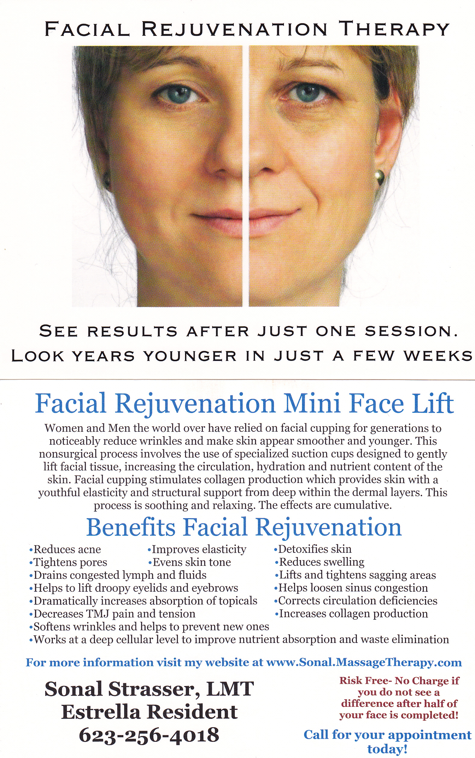 Facial Rejuvenation Therapy Mini Lift